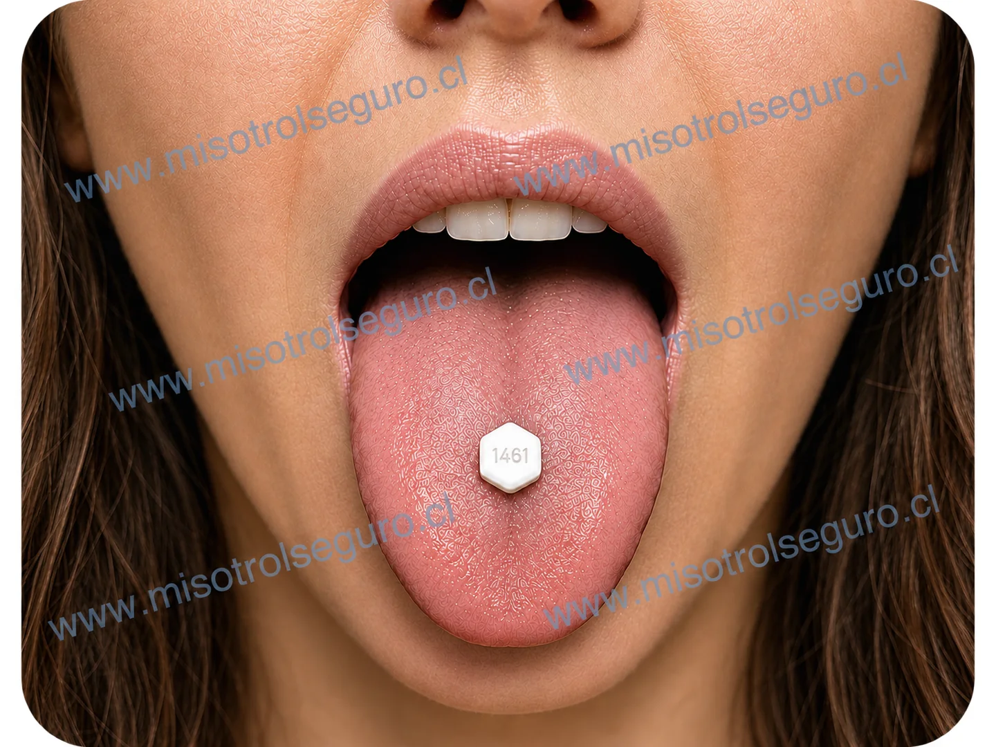 Tratamiento sublingual: mujer con una pastilla de misotrol sobre la lengua
